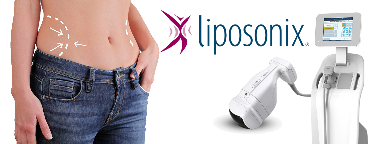 Liposonix HiFu Solta Medical Liposonix HiFu Solta Medical